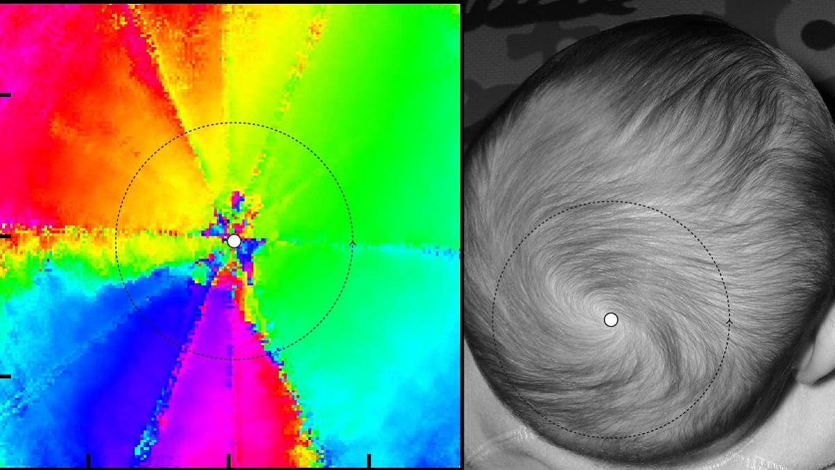 Data in the form of a rainbow laid out around a central point next to a whorl of hair on a baby's head.